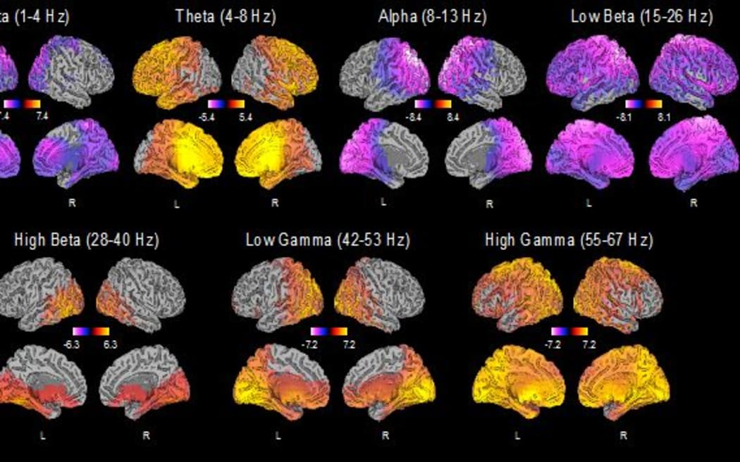 Ketamine injections for depression? New study shows promise, but is one ...