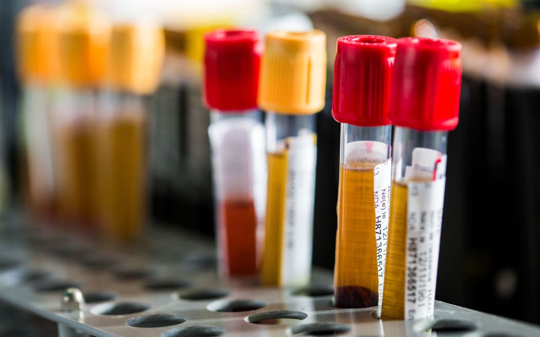 Blood samples with Hepatitis B and C viruses in a hospital in France