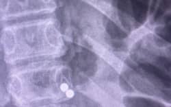 An X-ray of the magnets.