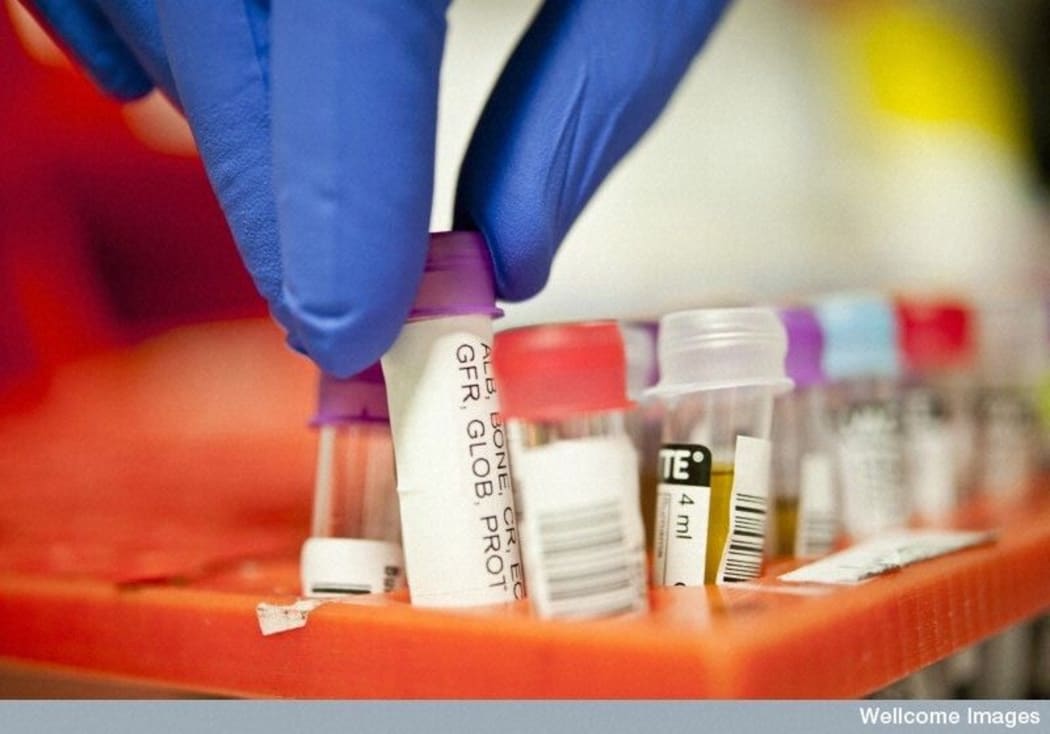blood testing vacuettes