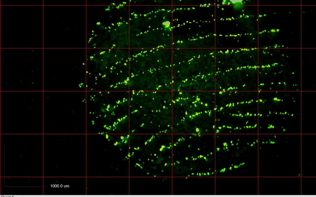 A fluorescent dye highlights DNA left on a fingerprint.