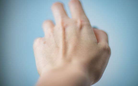 close up of white hand