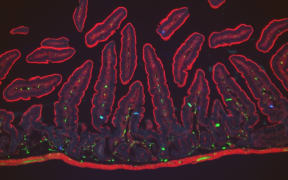 Enterochromaffin cells (blue) in finger-like projections within the gut villi (outlined in red) detect noxious chemicals.