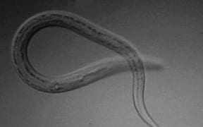 Necator americanus L3 infectious larva at 100x magnification