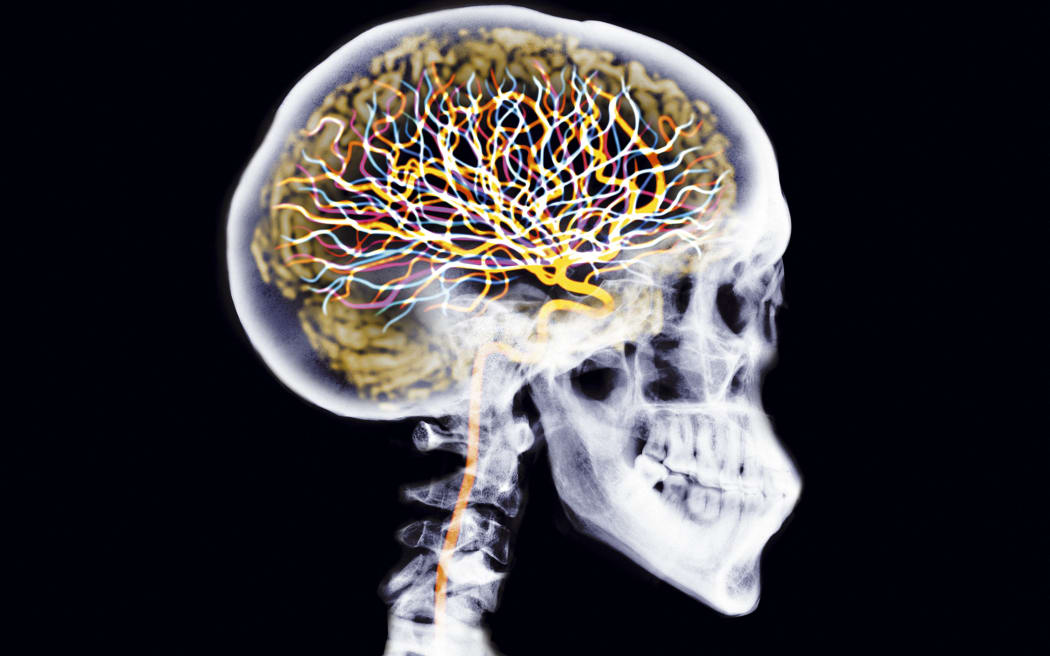 Skull showing brain and neurons, coloured X-ray. (Photo by NICK VEASEY/SCIENCE PHOTO LIBRAR / NVY / Science Photo Library via AFP)