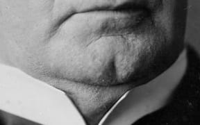 A fine example of a cleft chin, sported by US President William McKinley
