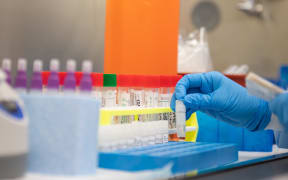 LAKE SUCCESS, NY - MARCH 11: A lab technician begins semi-automated testing for COVID-19 at Northwell Health Labs on March 11, 2020 in Lake Success, New York.