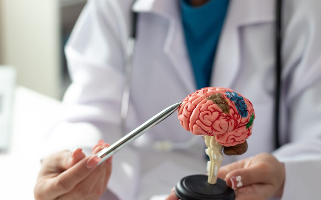 Alzheimer's disease Asian female doctor holds brain anatomy model for diagnosis and treatment, new modern clinic, complete tools to cure brain disease.