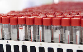 Samples of the coronavirus (Covid-19) PCR gargle test are pictured before further examination in the LifeBrain laboratory in Vienna on February 1, 2022.