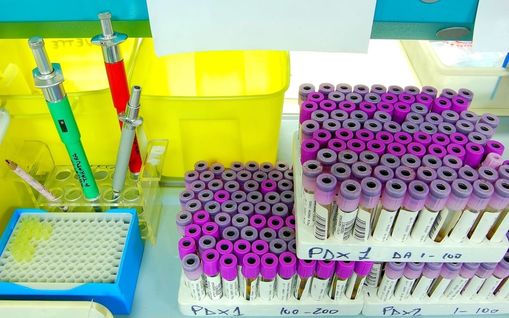 Pipettes and test tubes