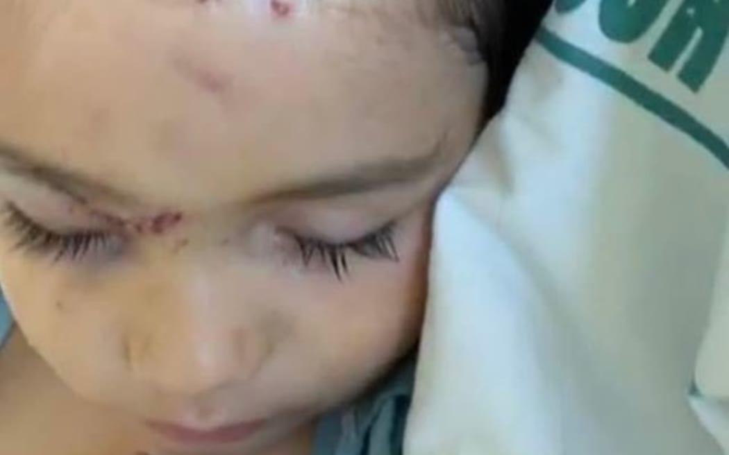 Azaiah suffered skull and head wounds from the attack.