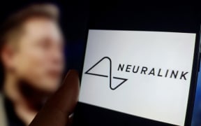 An illustration of Neuralink is being displayed in Suqian, Jiangsu Province, China, on January 30, 2024. Musk is announcing that Neuralink has completed the first human brain implant. (Photo Illustration by Costfoto/NurPhoto) (Photo by CFOTO / NurPhoto / NurPhoto via AFP)