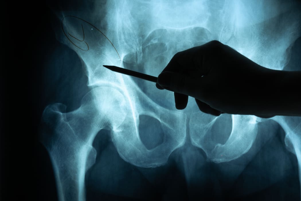 X ray film with doctor's hand to examine