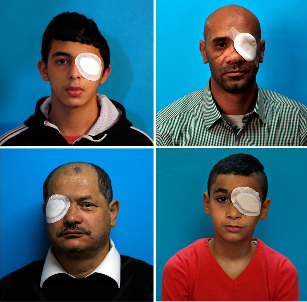 A collage of Palestinian men and youths in 2016 posing with a dressing pad on the eye that they lost, a few months after they were wounded by a sponged-tipped bullet used by Israeli security forces to disperse demonstrations.