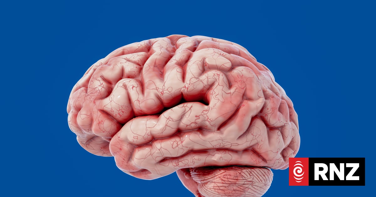 How your brain can be trained like a muscle