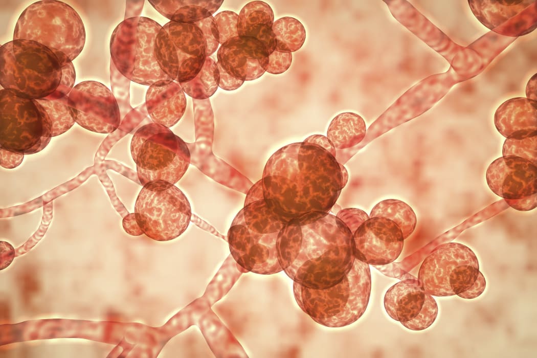 Candida auris, first identified in 2009, causes serious multidrug-resistant infections in hospital patients and has high mortality rates. It causes bloodstream, wound and ear infections and has also been isolated from respiratory and urine specimens.