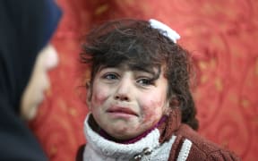 A 9-year-old girl receives treatment at a makeshift hospital following recent Syrian government bombardments on rebel-held town of Saqba.