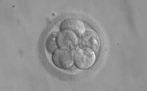 A human embryo, here seen in its eight-cell stage, doubles its number of cells at each division.
