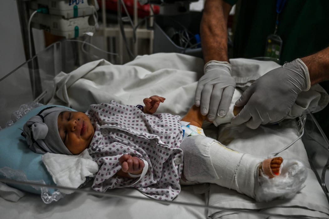 Newborn, Amina, receives treatment for the gun wound in her right leg.