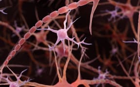 Microglia, computer illustration. Microglia are immune cells in the brain and spinal cord. (Photo by ARTUR PLAWGO / SCIENCE PHOTO LIB / APL / Science Photo Library via AFP)