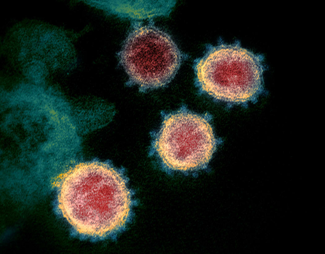 Transmission electron microscope image shows SARS-CoV-2, the virus that causes COVID-19—isolated from a patient in the U.S. Virus particles are shown emerging from the surface of cells cultured in the lab. The spikes on the outer edge of the virus particles give coronaviruses their name, crown-like.