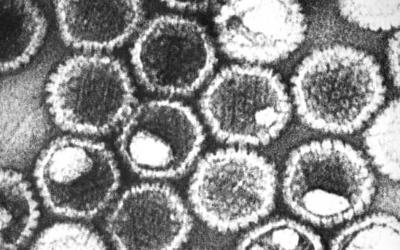Herpes Simplex Virus