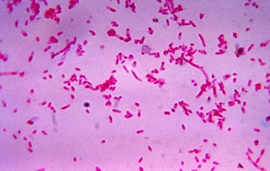 Fusobacterium novum in culture