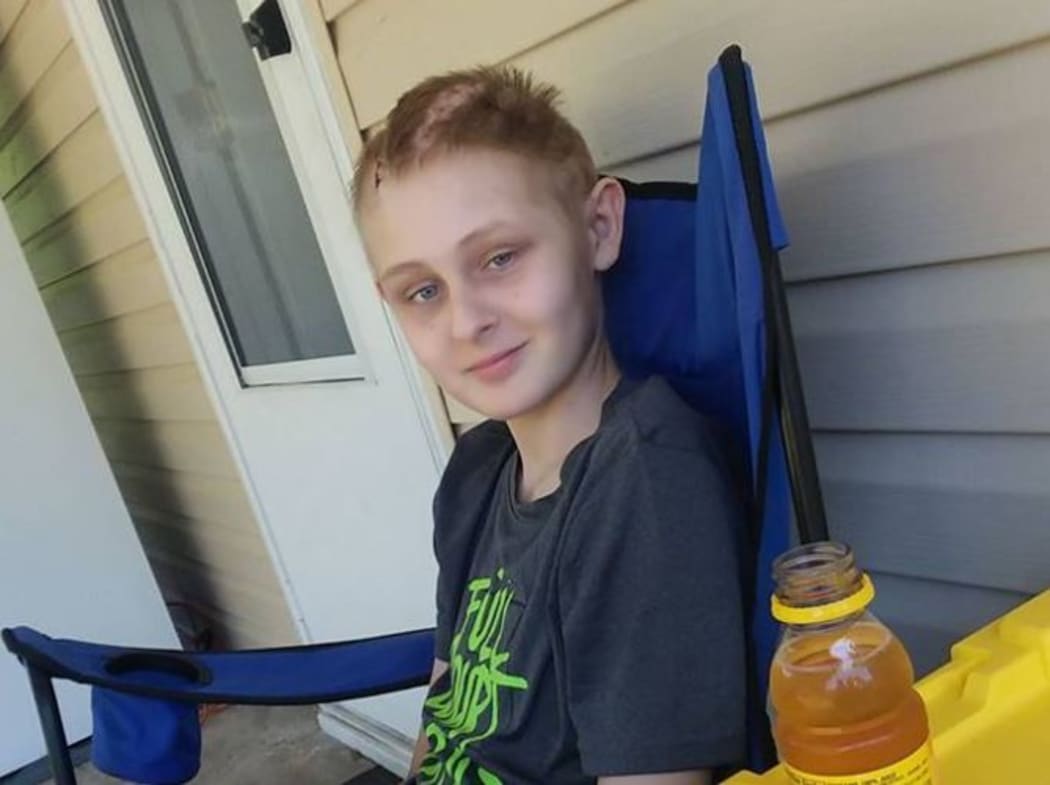 Trenton McKinley is now on a slow recovery process - half his skull must be re-connected.