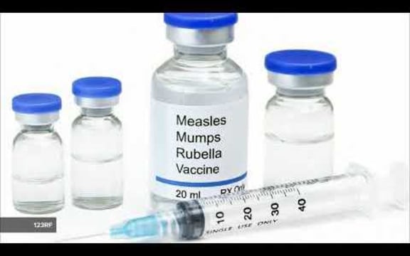 All Blacks at risk of contracting mumps: RNZ Checkpoint