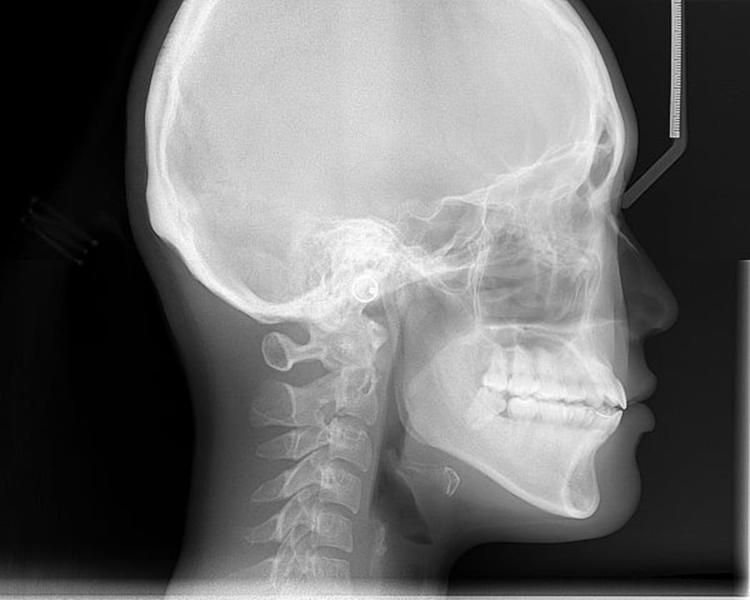 Skull view