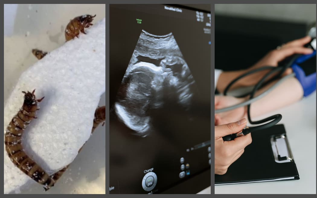 Worm, baby, blood pressure