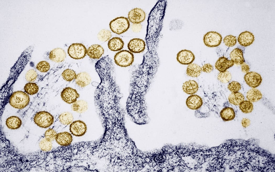 What is hantavirus and how does it spread? | RNZ News
