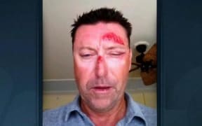 Australian golfer Robert Allenby