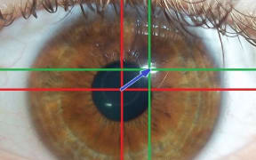 Visible light eye-tracking algorithm