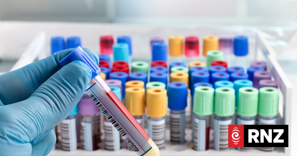 Awanui laboratory workers to strike over pay offer | RNZ