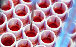 Blood test