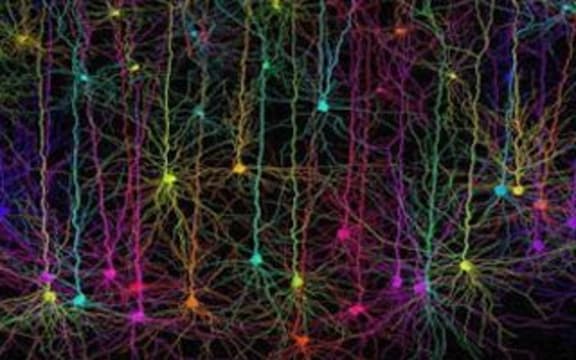 During Alzheimer's Disease, brain cells are gradually lost.