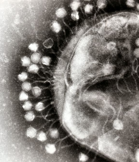bacteriophages on a bacteria