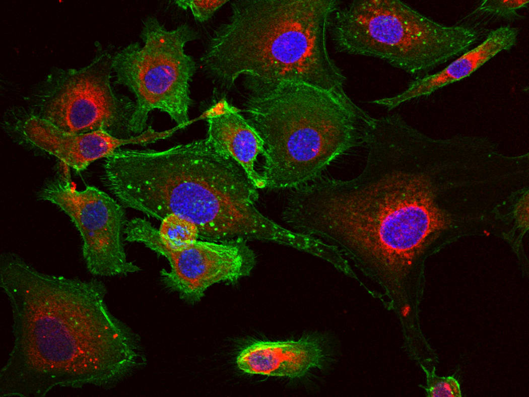 RNA Nanoparticles in Cancer Cells