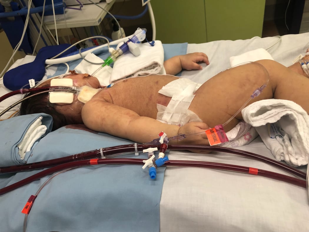 Lakyn-Ray when she was on life support.