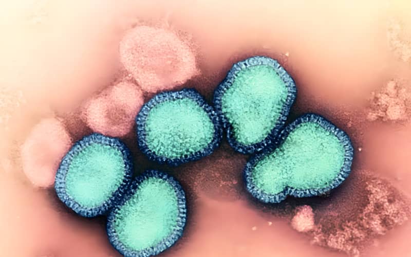 New Zealand Health System Faces Pressure from Late Flu Spike