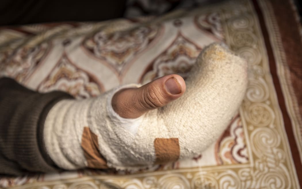 Gagon Dhamijaa had two fingers cut off during a road rage knife attack.