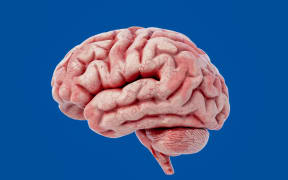 Research shows that the brain can be exercised, much like our muscles.