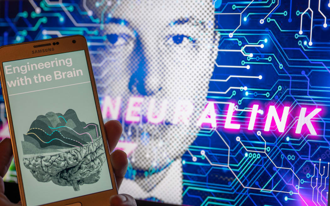 Elon Musk's Neuralink implants brain chip in first human | RNZ News