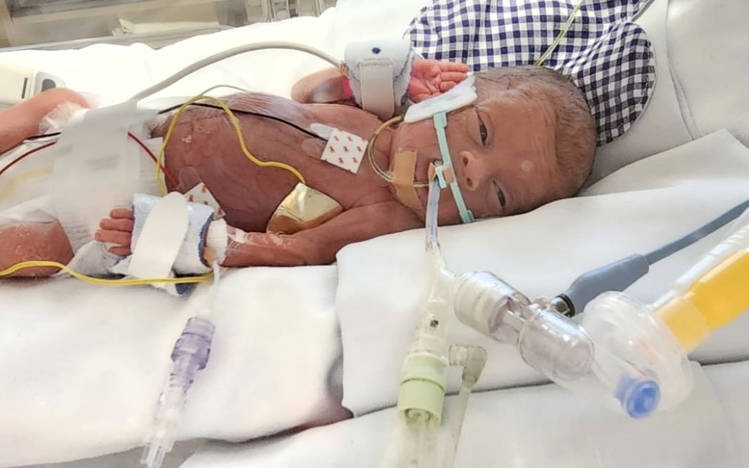 Christchurch Hospital Neonatal Intensive Care Unit to be expanded | RNZ ...