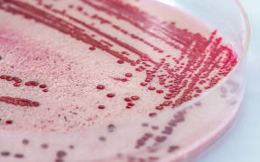 Listeria, bacteria in a petri dish.