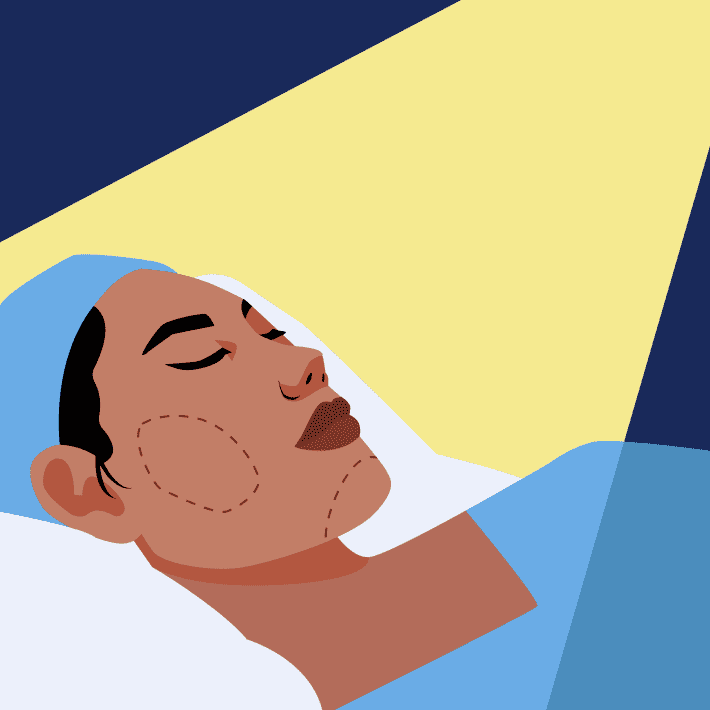 Cosmetic surgeons are reporting a growing number of patients with sagging skin and facial hollowing after losing weight with drugs.