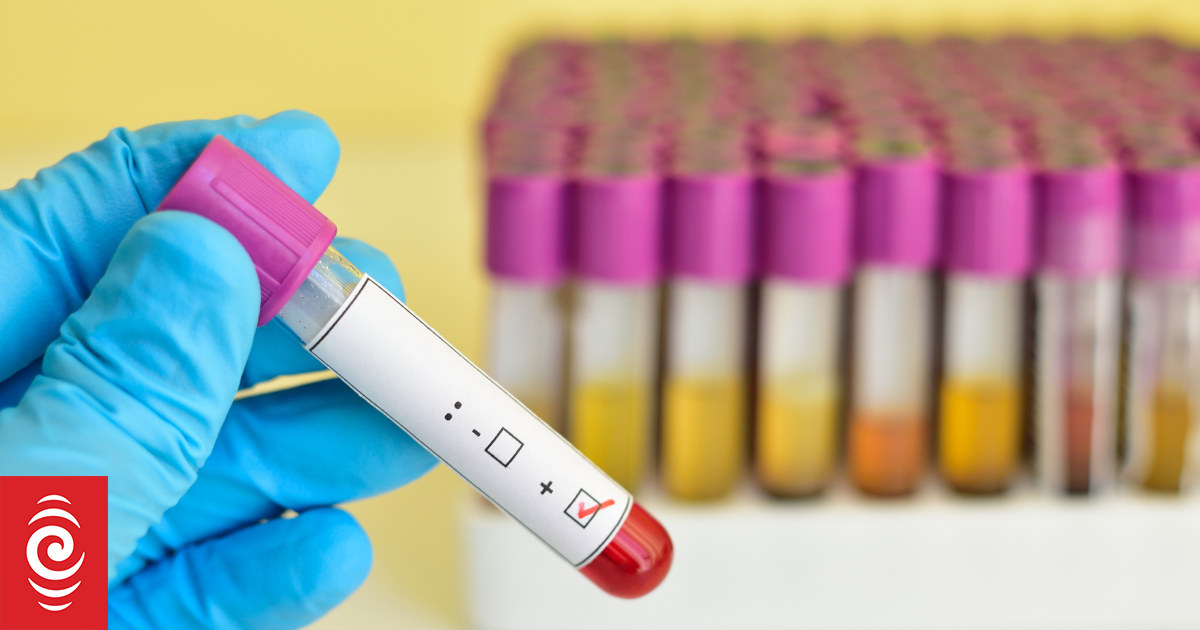 STIs on the rise: why aren't more people testing? | RNZ