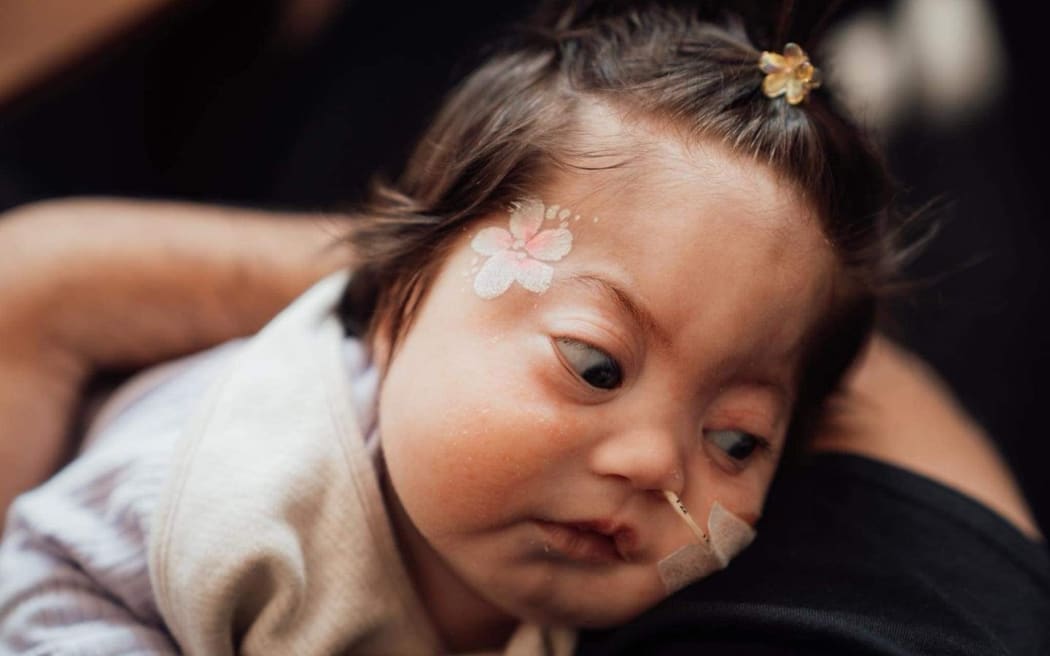 Although Luca struggled to move by herself, she is making progress and can now look in the mirror and touch her face by herself.