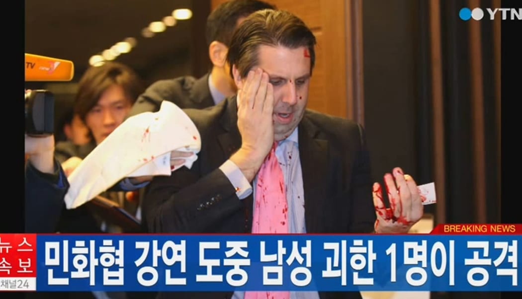 Footage from YTN News shows US Ambassador to South Korea Mark Lippert after being attacked in Seoul.